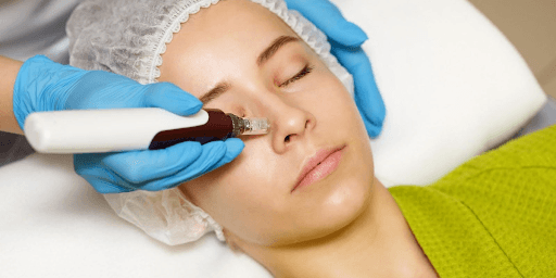  Park Slope Laser Aesthetic Center Offers Advanced Skin Rejuvenation With Potenza RF Microneedling In Brooklyn