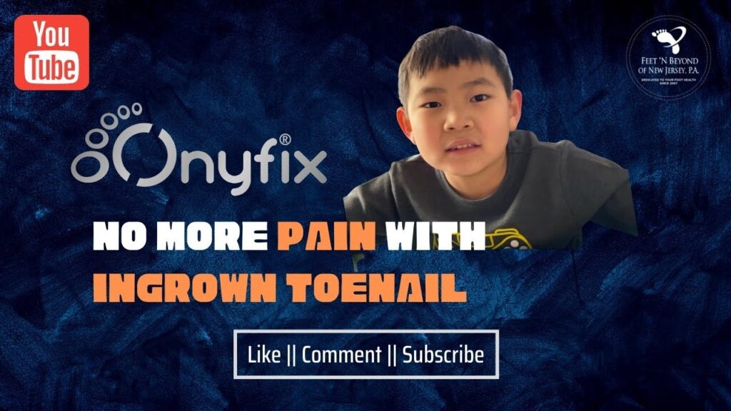 YouTube Video on Onyfix: "No more pain with ingrown toenails—Minimally invasive Onyfix treatment at Feet 'N Beyond."